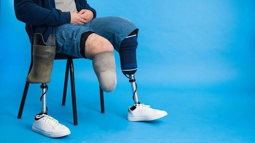 What Is the Average Settlement for Loss of Limb?