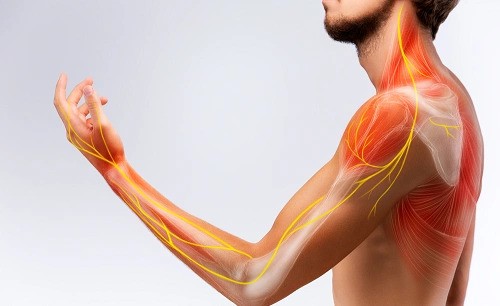 What Is the Average Settlement for Nerve Damage?
